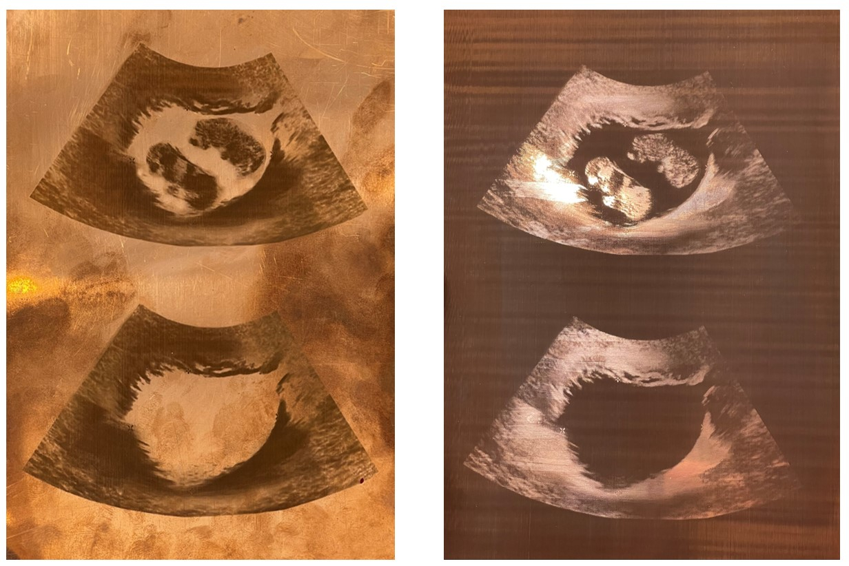 Laser-etched sonogram on copper